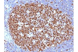 Formalin-fixed, paraffin-embedded human Tonsil stained with MCM7 Mouse Monoclonal Antibody (MCM7/1466).