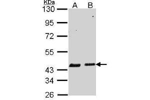 WB Image Sample (30 ug of whole cell lysate) A: A549 B: Hela 10% SDS PAGE antibody diluted at 1:1000 (SERPINB6 anticorps  (Internal Region))