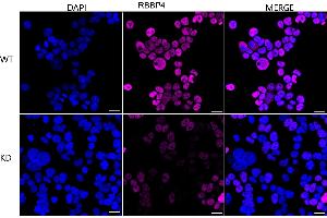 Immunocytochemical staining of HeLa cells using RBBP4 antibody (ABIN7800185), 1:1,000), Top panel: wild-type (WT), Bottom panal: RBBP4 shRNA knockdown (KD). (Recombinant Retinoblastoma Binding Protein 4 anticorps)