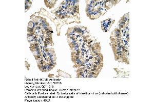 Human Intestine (MCM8 anticorps  (C-Term))