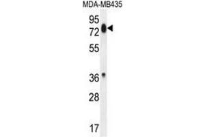 Western blot analysis in MDA-MB435 cell line lysates (35ug/lane) using PCDHB13  Antibody . (PCDHB13 anticorps  (Middle Region))