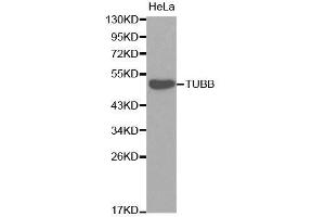 Western blot analysis of extracts of HeLa cells, using TUBB antibody. (TUBB anticorps)