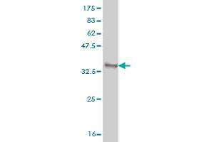 Western Blot detection against Immunogen (33. (GBX2 anticorps  (AA 114-182))