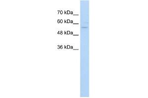 WB Suggested Anti-ZNF19 Antibody Titration:  5. (ZNF19 anticorps  (C-Term))