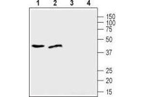 Western blot analysis of human U-87 MG glioblastoma cell lysate (lanes 1 and 3) and human MDA-231 breast adenocarcinoma cell lysate (lanes 2 and 4): - 1,2. (SLC39A1 anticorps  (Extracellular, N-Term))
