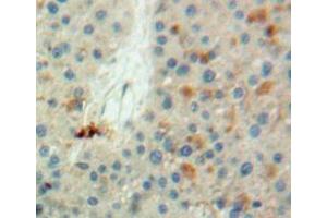IHC-P analysis of liver tissue, with DAB staining. (LDHB anticorps  (AA 1-334))
