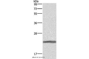 Western blot analysis of Human placenta tissue, using GH1 Polyclonal Antibody at dilution of 1:500 (Growth Hormone 1 anticorps)