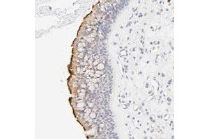 Immunohistochemical staining (Formalin-fixed paraffin-embedded sections) of human nasopharynx shows strong membranous positivity in respiratory epithelial cells. (CYP4B1 anticorps  (AA 64-186))