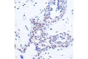 Immunohistochemistry of paraffin-embedded Human breast using SRSF11 Rabbit pAb (ABIN7270215) at dilution of 1:100 (40x lens). (SRSF11 anticorps)