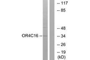 Western Blotting (WB) image for anti-Olfactory Receptor, Family 4, Subfamily C, Member 16 (OR4C16) (AA 261-310) antibody (ABIN2891005) (OR4C16 anticorps  (AA 261-310))
