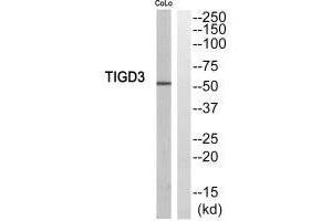 Western blot analysis of extracts from COLO205 cells, using TIGD3 antibody. (TIGD3 anticorps  (C-Term))