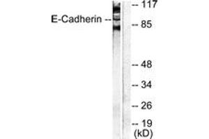 Western blot analysis of extracts from NIH-3T3 cells, using Cadherin-pan Antibody. (Cadherin anticorps  (AA 833-882))