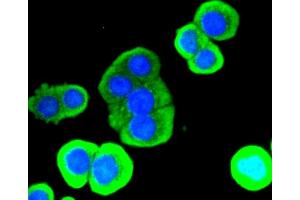 Immunofluorescence analysis of CRC cells using LYZ antibody. (LYZ anticorps)