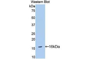 Western blot analysis of the recombinant protein. (IL18R1 anticorps  (AA 391-518))