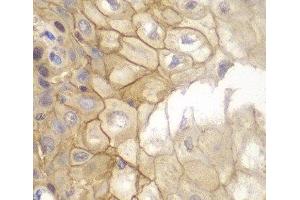 Immunohistochemistry of paraffin-embedded Human esophagus using IL7R Polyclonal Antibody at dilution of 1:100 (40x lens). (IL7R anticorps)