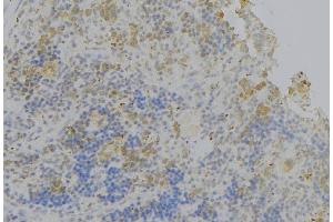 ABIN6278483 at 1/100 staining Human lymph node tissue by IHC-P. (IL4 Receptor anticorps  (N-Term))