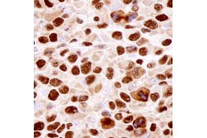 Immunohistochemistry (IHC) image for anti-Heterogeneous Nuclear Ribonucleoprotein K (HNRNPK) (C-Term) antibody (ABIN7448598)