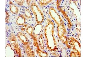 Immunohistochemistry of paraffin-embedded human kidney tissue using ABIN7154587 at dilution of 1:100 (GEM anticorps  (AA 1-150))