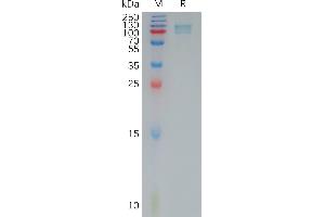 Human POSTN Protein, His Tag on SDS-PAGE under reducing condition.