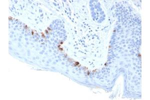 Formalin-fixed, paraffin-embedded human Skin stained with TYRP1-Monospecific Mouse Monoclonal Antibody (TYRP1/3283). (Tyrosinase-Related Protein 1 anticorps  (AA 257-377))