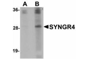 Image no. 1 for anti-Synaptogyrin 4 (SYNGR4) (N-Term) antibody (ABIN478102) (SYNGR4 anticorps  (N-Term))