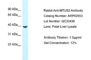 Western Blotting (WB) image for anti-Microtubule-associated Tumor Suppressor Candidate 2 (MTUS2) (C-Term) antibody (ABIN2789268) (CAZIP anticorps  (C-Term))