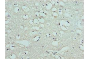 Immunohistochemistry of paraffin-embedded human brain tissue using ABIN7152238 at dilution of 1:100
