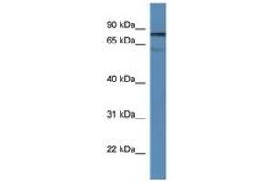 Image no. 1 for anti-Tyrosyl-DNA Phosphodiesterase 1 (TDP1) (AA 350-399) antibody (ABIN6746494) (TDP1 anticorps  (AA 350-399))
