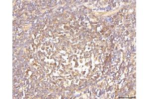 IHC analysis of EIF4B using anti-EIF4B antibody (ABIN7599496).