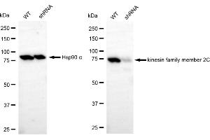Western blotting analysis using kinesin family member 2C antibody (ABIN7799206). (Recombinant KIF2C anticorps)