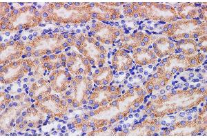 Immunohistochemistry of paraffin-embedded Mouse kidney using HPGD Polyclonal Antibody at dilution of 1:200 (HPGD anticorps)