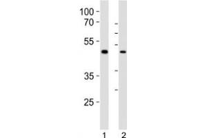 Western blot analysis of lysate from 1) human LNCaP and 2) mouse F9 cell line using Sox17 antibody at 1:1000.