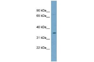 WB Suggested Anti-SLC39A2 Antibody Titration:  0. (ZIP2 anticorps  (N-Term))