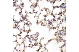 Immunohistochemistry of paraffin-embedded Mouse lung using ALOX15B antibody at dilution of 1:100 (x400 lens).