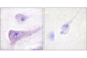 Immunohistochemistry analysis of paraffin-embedded human brain, using WASP (Phospho-Tyr290) Antibody.