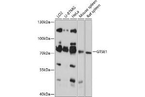 Western blot analysis of extracts of various cell lines, using GTSE1 antibody (ABIN6130407, ABIN6141523, ABIN6141525 and ABIN6218071) at 1:3000 dilution.