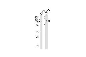 Western blot analysis of lysates from Hela, 293T cell line (from left to right), using SNX1 Antibody at 1:1000 at each lane. (Sorting Nexin 1 anticorps  (C-Term))