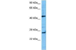 Host:  Mouse  Target Name:  TCF7  Sample Tissue:  Mouse Testis  Antibody Dilution:  1ug/ml (TCF7 anticorps  (N-Term))