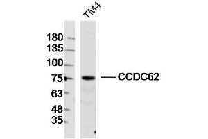 TM4 lysates probed with CCDC62 Polyclonal Antibody, Unconjugated  at 1:300 dilution and 4˚C overnight incubation. (CCDC62 anticorps  (AA 1-100))