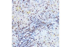 Immunohistochemistry of paraffin-embedded rat spleen using OGT Rabbit pAb (ABIN3022707, ABIN3022708, ABIN3022709 and ABIN6219152) at dilution of 1:100 (40x lens).