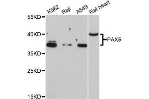 Western blot analysis of extracts of various cell lines, using PAX5 antibody (ABIN5998458) at 1/1000 dilution. (PAX5 anticorps)
