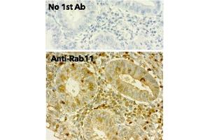 Immunohistochemistry (IHC) image for anti-RAB11A, Member RAS Oncogene Family (RAB11A) (C-Term) antibody (ABIN1440025)