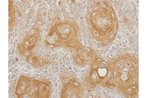 anti-Inositol Polyphosphate-5-Phosphatase, 75kDa (INPP5B) (C-Term) antibody