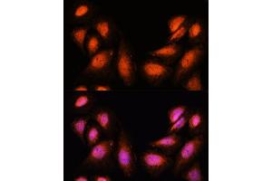 Immunofluorescence analysis of U-2 OS cells using SUPT6H antibody (ABIN7270645) at dilution of 1:100.