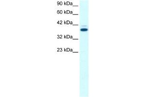 WB Suggested Anti-GABPB2 Antibody Titration:  0. (GABPB2 anticorps  (C-Term))