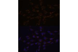 Immunofluorescence analysis of C6 cells using RGS4 antibody (ABIN7269898) at dilution of 1:100.