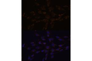 Immunofluorescence analysis of C6 cells using RGS4 antibody (ABIN7269898) at dilution of 1:100. (RGS4 anticorps  (AA 1-100))