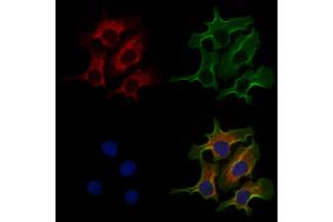 ABIN6258659 and ABIN6274961 staining Hela cells by IF/ICC. (CA5A anticorps  (Internal Region))
