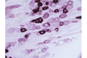 Immunohistochemical staining of Trpv2 in rat trigeminal ganglion using Trpv2 polyclonal antibody .