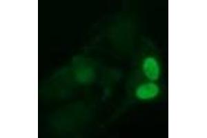 Image no. 2 for anti-Ubiquitin-Conjugating Enzyme E2S (UBE2S) antibody (ABIN1501646) (UBE2S anticorps)